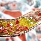 Arterials