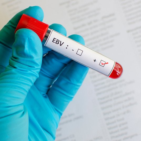 Blood sample tube labelled EBV