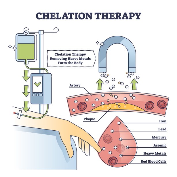 Chelation therapy diagram