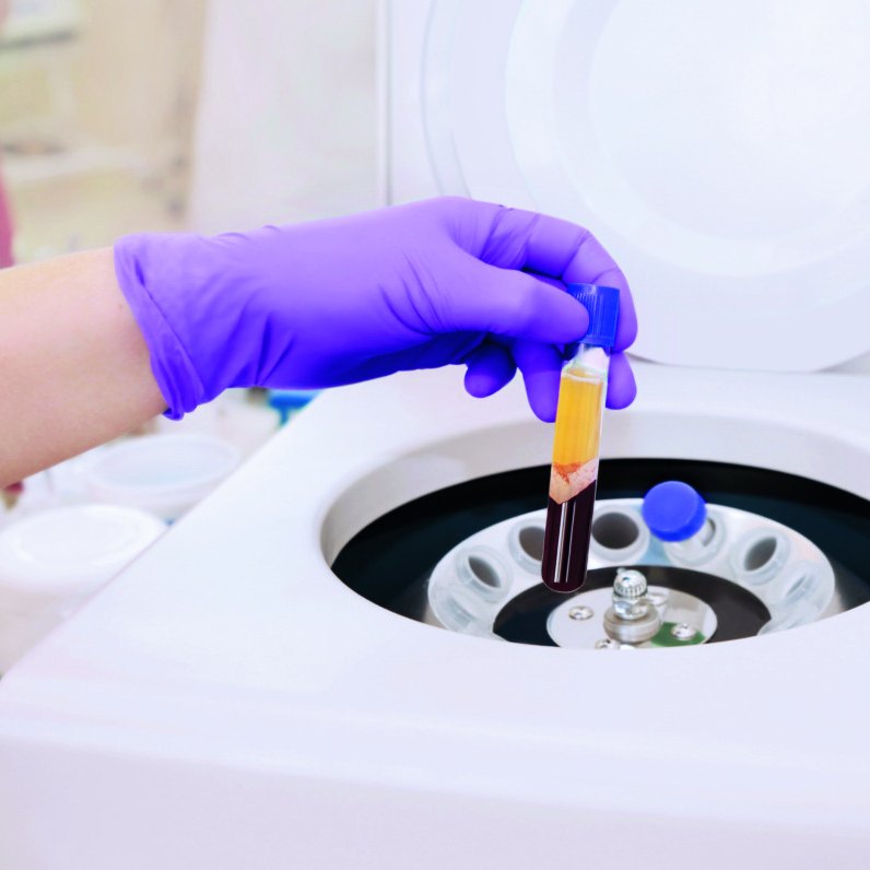 Centrifuge spinning a blood sample