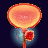 Prostate