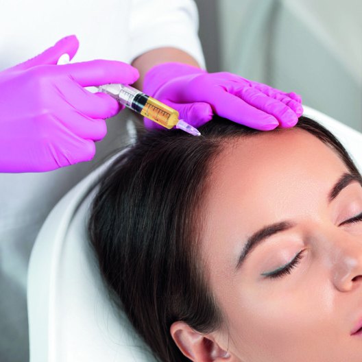 PRP scalp injection for hair loss